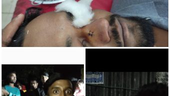 গাজীপুরে সাংবাদিকের ওপর বর্বর হামলা: প্রকাশ্যে মাদক সেবন ধামাচাপা দিতে বার্মিজ চাকু নিয়ে আক্রমণ