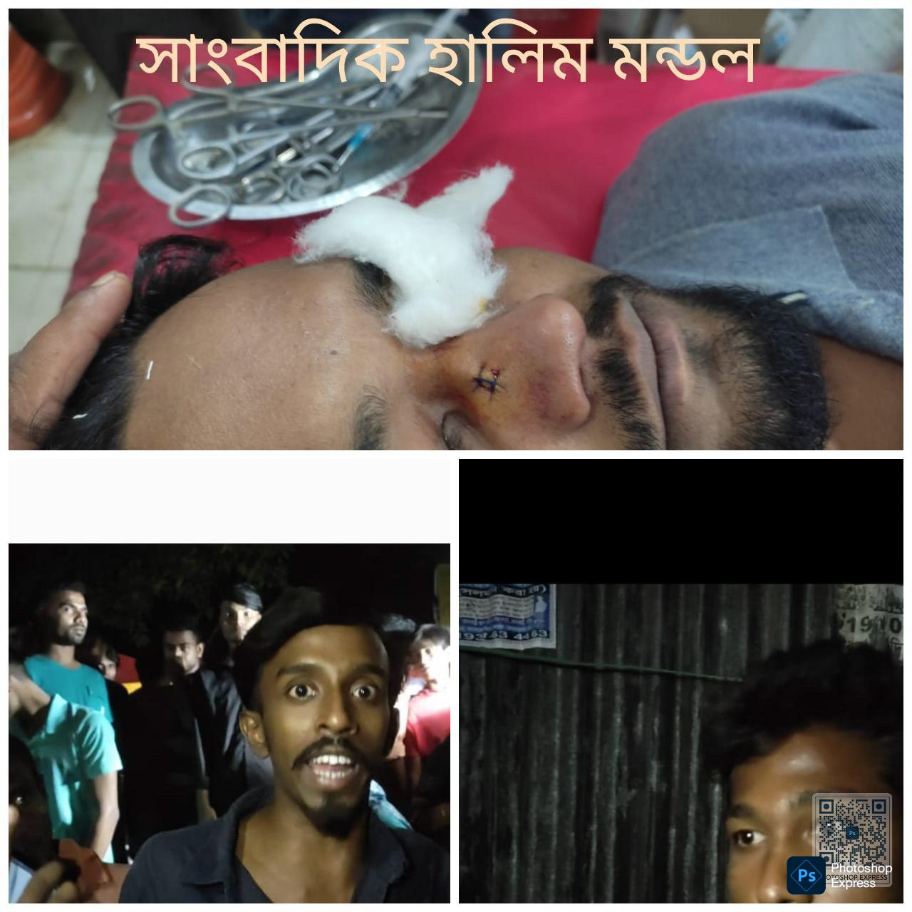 গাজীপুরে সাংবাদিকের ওপর বর্বর হামলা: প্রকাশ্যে মাদক সেবন ধামাচাপা দিতে বার্মিজ চাকু নিয়ে আক্রমণ