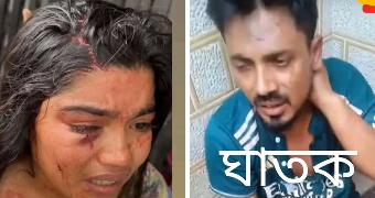 দিনাজপুর ফুলবাড়ীতে স্ত্রীকে কে ছুরি আঘাত স্বামী আটক।