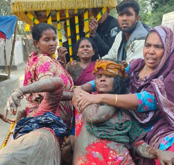ফরিদপুরে জমি বিরোধে রক্তাক্ত পুঙ্গলীঃ হত্যার উদ্দেশ্যে হামলায় তিন নারী গুরুতর আহত