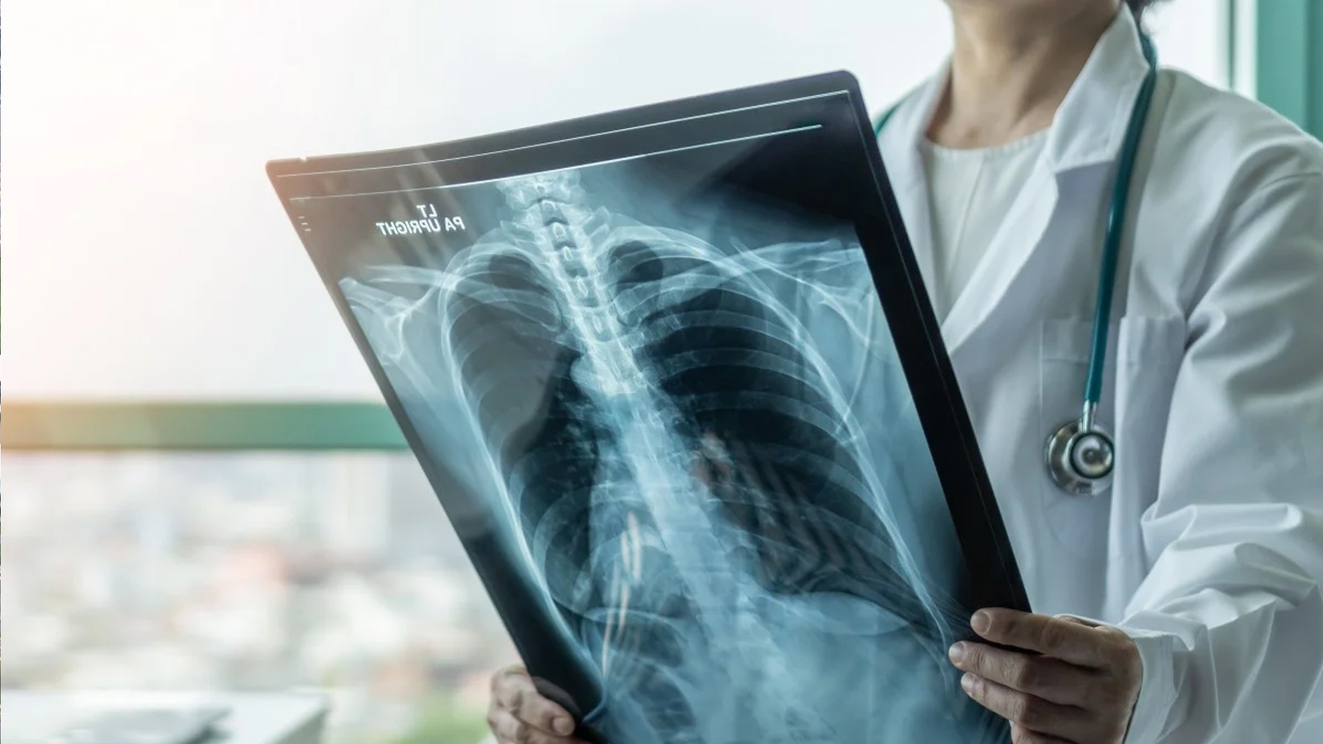 মালয়েশিয়ায় দ্রুত ছড়াচ্ছে যক্ষ্মা, বিশেষ সতর্কতা জারি।